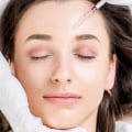 Where Can Botox Be Injected in the Face to Reduce Signs of Aging?