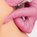Does Botox Weaken Muscles Over Time?