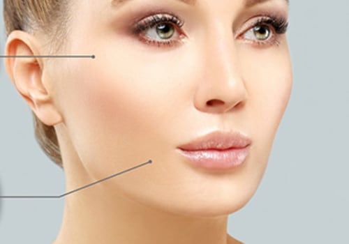 How Long Does Botox Last? Expert Tips to Maximize Results