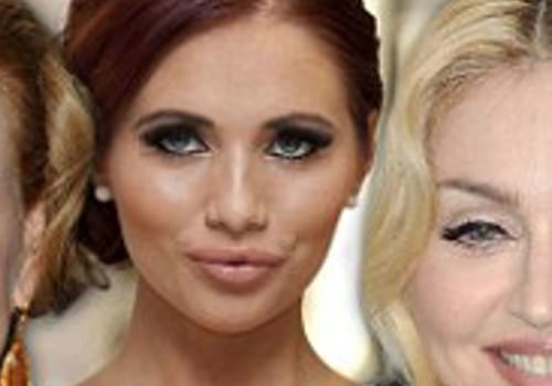 Does Botox Make You Look Younger?