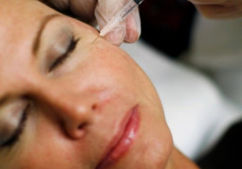 How Much Did Allergan Pay for Botox?